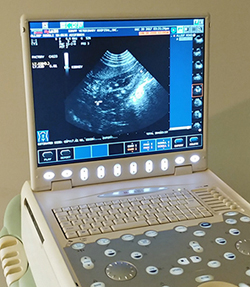 Ultrasound Machine