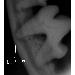 Thumbnail of photo in album